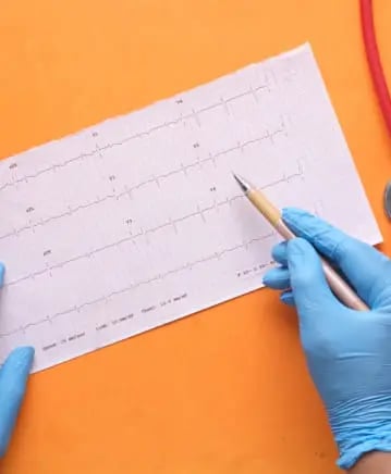 ECG