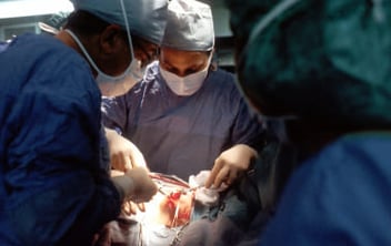Operation